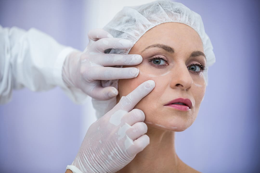 rinoplastia